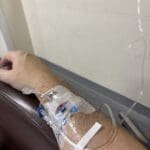 Chemo Arm