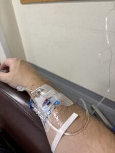 Chemo Arm